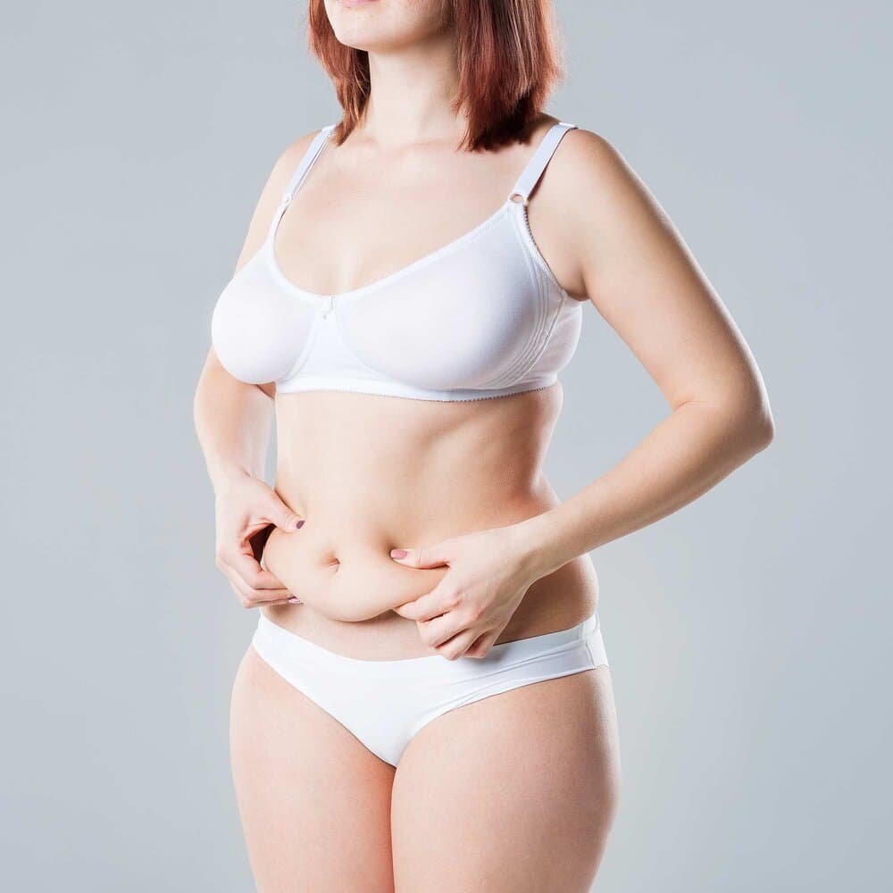 Tummy Tuck
